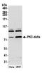 Protein kinase C delta type antibody, A302-448A, Bethyl Labs, Western Blot image 