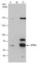 Serine/Threonine Kinase 4 antibody, PA5-22015, Invitrogen Antibodies, Immunoprecipitation image 