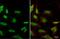 X-Ray Repair Cross Complementing 5 antibody, GTX70274, GeneTex, Immunocytochemistry image 