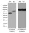 Phosphoglycerate Dehydrogenase antibody, LS-C791008, Lifespan Biosciences, Western Blot image 