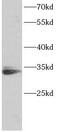 TNF Receptor Superfamily Member 6b antibody, FNab10344, FineTest, Western Blot image 