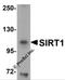 hSIRT1 antibody, 5765, ProSci Inc, Western Blot image 
