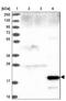 Sftpa antibody, NBP2-46679, Novus Biologicals, Western Blot image 
