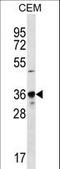 Phosducin antibody, LS-C163458, Lifespan Biosciences, Western Blot image 