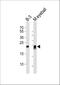 Crystallin Beta B2 antibody, A04928, Boster Biological Technology, Western Blot image 