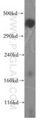 BRCA2 antibody, 19791-1-AP, Proteintech Group, Western Blot image 
