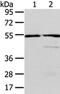 Aldehyde Dehydrogenase 3 Family Member A2 antibody, CSB-PA090286, Cusabio, Western Blot image 