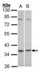 Complement Component 5a Receptor 2 antibody, orb73950, Biorbyt, Western Blot image 