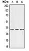 Fc Fragment Of IgG Receptor IIc (Gene/Pseudogene) antibody, LS-B13616, Lifespan Biosciences, Western Blot image 