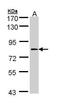 Coagulation Factor XIII A Chain antibody, TA308878, Origene, Western Blot image 