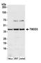 Tropomodulin 3 antibody, A305-451A, Bethyl Labs, Western Blot image 