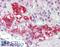 Forkhead Box O1 antibody, LS-B4151, Lifespan Biosciences, Immunohistochemistry paraffin image 