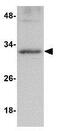 Glucosamine-6-Phosphate Deaminase 2 antibody, GTX85346, GeneTex, Western Blot image 