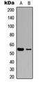 Myocyte Enhancer Factor 2C antibody, MBS8214104, MyBioSource, Western Blot image 