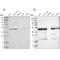 Cytochrome b-c1 complex subunit 2, mitochondrial antibody, PA5-52500, Invitrogen Antibodies, Western Blot image 