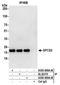 Signal Peptidase Complex Subunit 2 antibody, A305-608A-M, Bethyl Labs, Immunoprecipitation image 