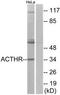 ACTH receptor antibody, TA311785, Origene, Western Blot image 