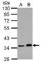 Protein Phosphatase, Mg2+/Mn2+ Dependent 1J antibody, GTX103370, GeneTex, Western Blot image 