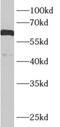 G protein-activated inward rectifier potassium channel 1 antibody, FNab04492, FineTest, Western Blot image 