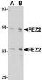 Fasciculation And Elongation Protein Zeta 2 antibody, TA306504, Origene, Western Blot image 