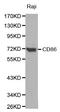 CD86 antibody, STJ113561, St John