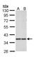 Aldo-Keto Reductase Family 1 Member B10 antibody, LS-B12467, Lifespan Biosciences, Western Blot image 