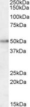 Hypocretin Receptor 2 antibody, NB100-74579, Novus Biologicals, Western Blot image 