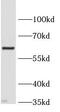 Solute carrier family 2, facilitated glucose transporter member 9 antibody, FNab10270, FineTest, Western Blot image 