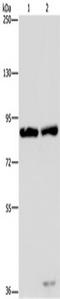 MRE11 Homolog, Double Strand Break Repair Nuclease antibody, TA350181, Origene, Western Blot image 