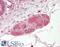 Kruppel Like Factor 8 antibody, 45-078, ProSci, Western Blot image 