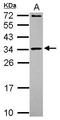 Mitochondrial Ribosomal Protein L10 antibody, GTX118664, GeneTex, Western Blot image 