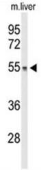 DiGeorge Syndrome Critical Region Gene 2 antibody, AP51249PU-N, Origene, Western Blot image 
