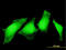 Aspartoacylase antibody, LS-C196702, Lifespan Biosciences, Immunofluorescence image 