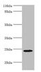 MIS12 Kinetochore Complex Component antibody, CSB-PA875639LA01HU, Cusabio, Western Blot image 