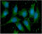 S100 Calcium Binding Protein A11 antibody, GTX57683, GeneTex, Immunocytochemistry image 