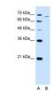 Phosphofructokinase, Liver Type antibody, NBP1-56607, Novus Biologicals, Western Blot image 