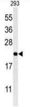 Melanocortin-2 receptor accessory protein antibody, GTX53669, GeneTex, Western Blot image 