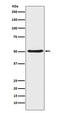 Angiopoietin 2 antibody, M00370-1, Boster Biological Technology, Western Blot image 