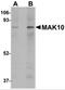 N(Alpha)-Acetyltransferase 35, NatC Auxiliary Subunit antibody, 5273, ProSci, Western Blot image 