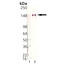 TNF Receptor Superfamily Member 13C antibody, M02865, Boster Biological Technology, Western Blot image 