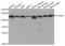 Catenin alpha-1 antibody, TA332804, Origene, Western Blot image 