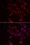 Ribosomal Protein L11 antibody, STJ28490, St John