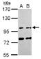 Family With Sequence Similarity 171 Member A1 antibody, NBP2-16414, Novus Biologicals, Western Blot image 