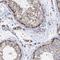 Rea antibody, NBP2-13754, Novus Biologicals, Immunohistochemistry paraffin image 