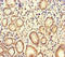 BUB1 Mitotic Checkpoint Serine/Threonine Kinase antibody, LS-C677324, Lifespan Biosciences, Immunohistochemistry paraffin image 