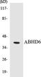 Abhydrolase Domain Containing 6 antibody, EKC1009, Boster Biological Technology, Western Blot image 