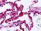 SS18 Subunit Of BAF Chromatin Remodeling Complex antibody, orb137598, Biorbyt, Immunohistochemistry paraffin image 