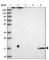 Cerebral Dopamine Neurotrophic Factor antibody, HPA044587, Atlas Antibodies, Western Blot image 