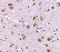 SATB Homeobox 1 antibody, 4631, ProSci, Immunohistochemistry paraffin image 