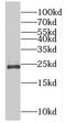 RAB9B, Member RAS Oncogene Family antibody, FNab07050, FineTest, Western Blot image 